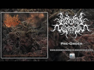 Postcoital Ulceration - Chaotic Growth Of Chronic Malignant Neoplasms (2014) PRE-ORDER NOW!